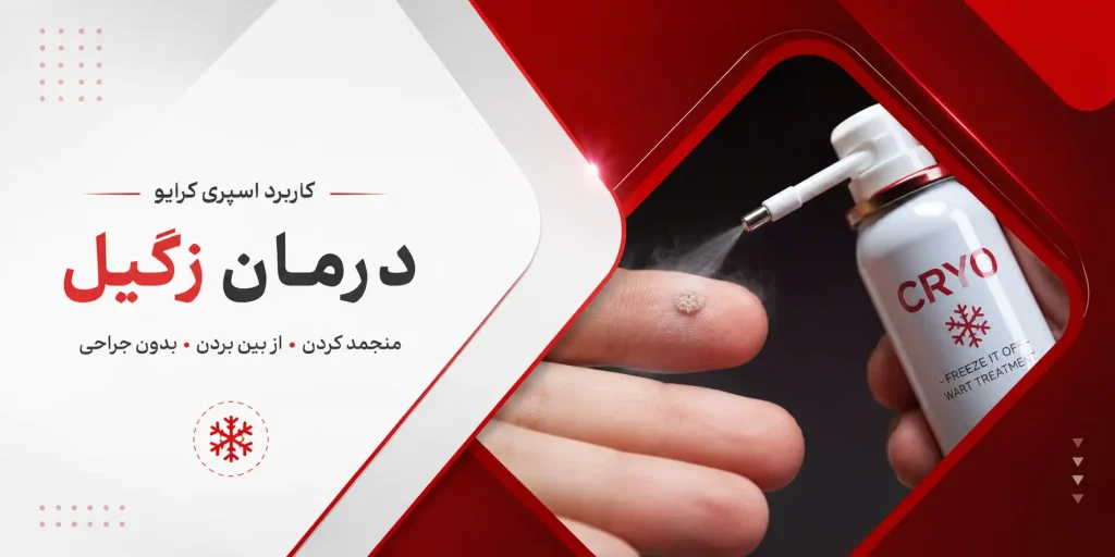 اسپری کرایو