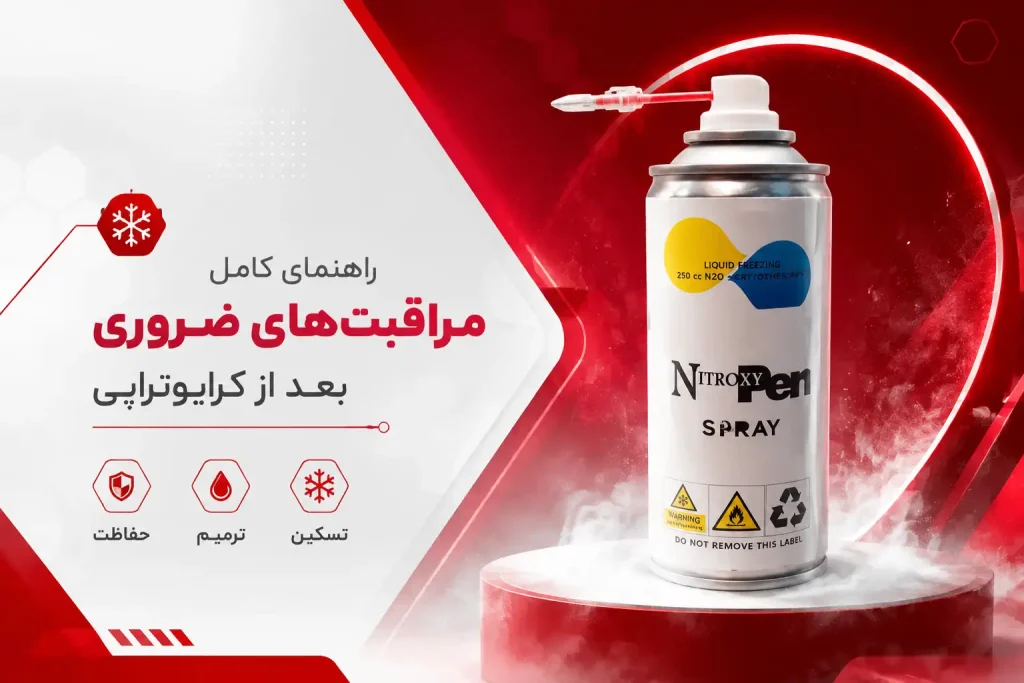 اسپری کرایو نیتروکسی خانگی