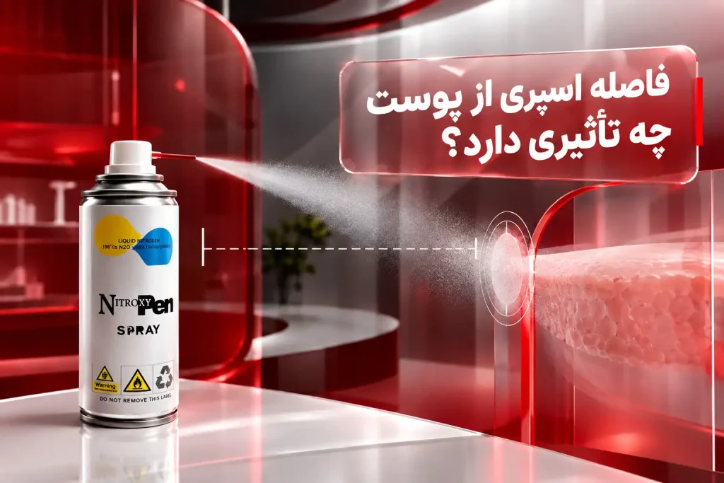 اسپری کرایو