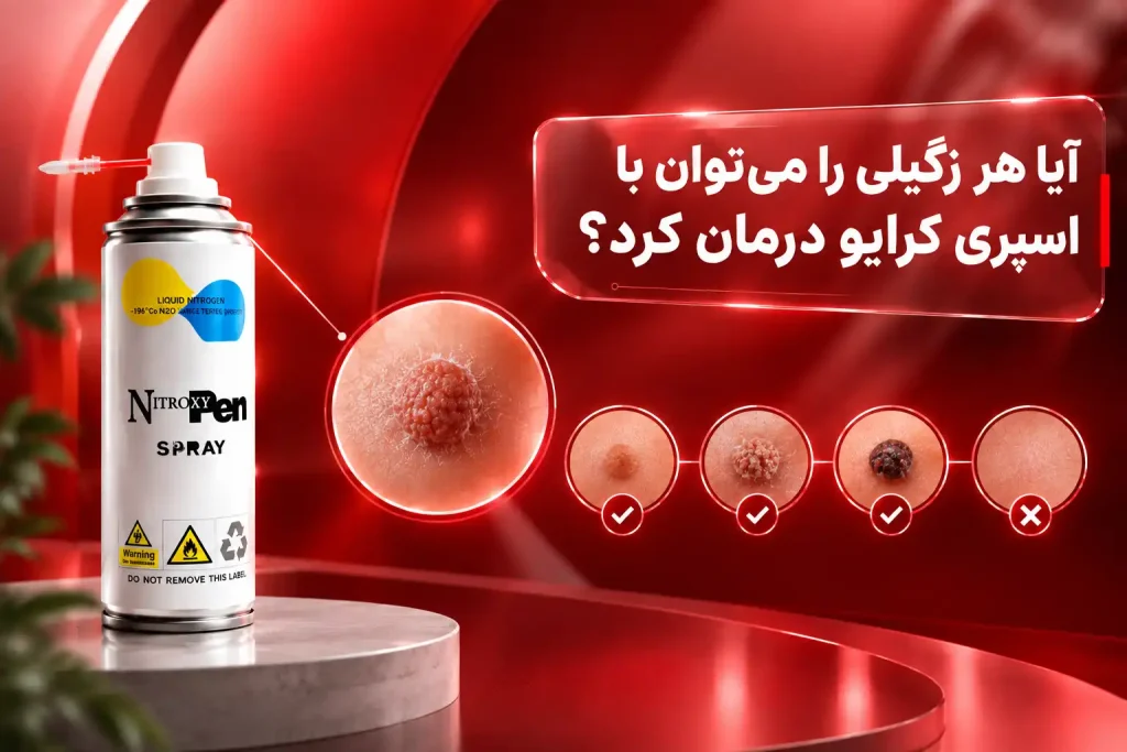 اسپری کرایو